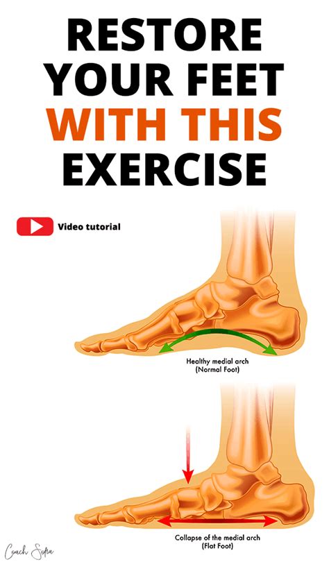 Fix Flat Feet With This One Simple Exercise - Coach Sofia Fitness