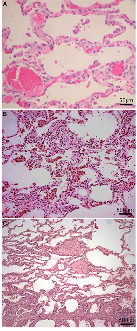 Chronic passive congestion. a Visible remodeling of extracellular ...