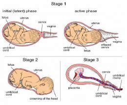 Stages of Labour and Collusion | Dr Rachel Reed