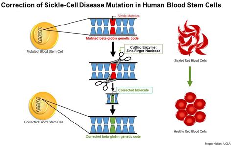 UCLA stem cell researchers develop promising method to treat sickle ...