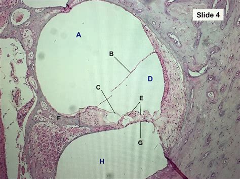 Cochlea Histology Diagram | Quizlet