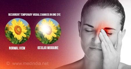 Ocular Migraine Blind Spot