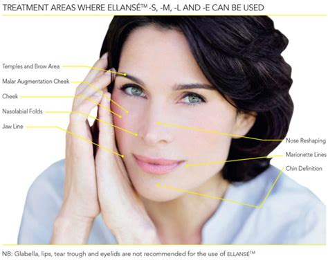 Ellanse Dermal Fillers 少女针 | Mizu Aesthetic Clinic Singapore