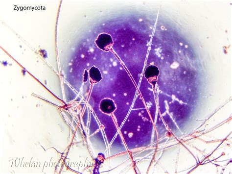 Zygomycota | Farm Fungal Pathogens in Olympia