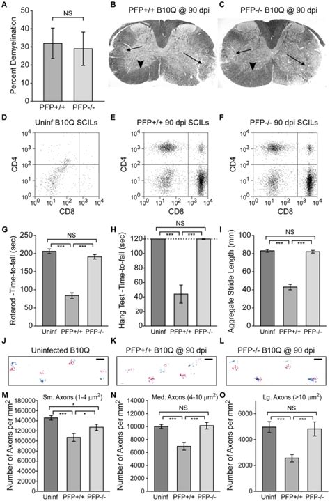 Absence of perforin confers protection of motor function and ...