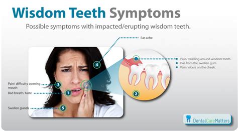 wisdom-tooth-symptoms-1024x566