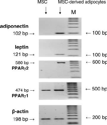 Induction of adipocyte markers in MSC-derived adipocytes. MSC were ...