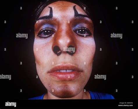 Disfigured face hi-res stock photography and images - Alamy