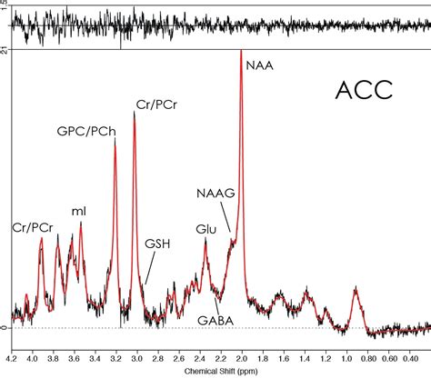 Measuring Differences in Brain Chemicals in People with Mild Memory ...