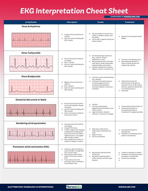 Printable Ekg Interpretation Cheat Sheet