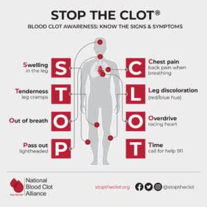 How To Cure A Blood Clot - Trackreply4