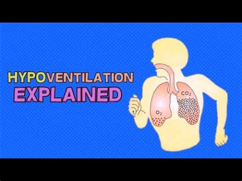 WHAT IS HYPOVENTILATION? DEFINITION, SYMPTOMS AND CAUSES - YouTube