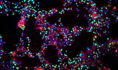 New study reveals causes of stem cell transplant rejection