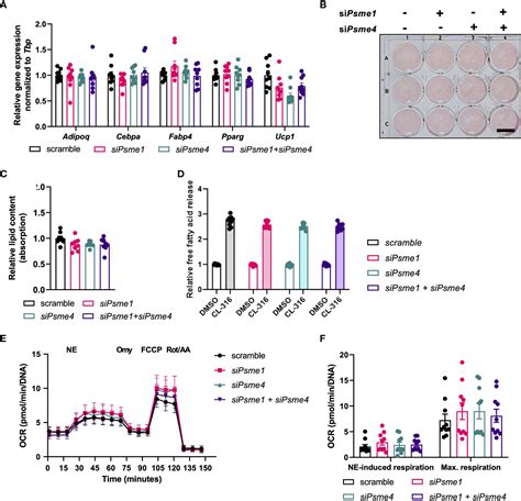 Frontiers | The role of proteasome activators PA28αβ and PA200 in brown ...