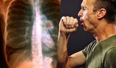 Lung cancer symptoms: Signs in your cough of the deadly disease ...