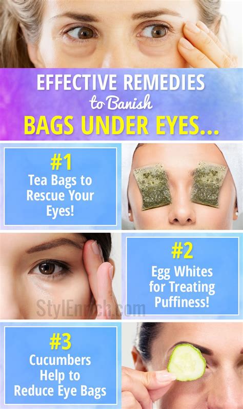 How to Get Rid of Eye Bags : Effective Remedies to Banish Puffy Eyes