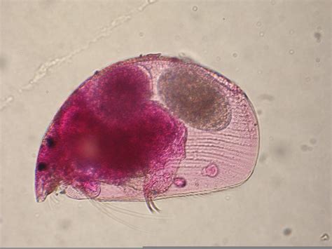 Zooplankton Counting and Classification - Eric Hanson