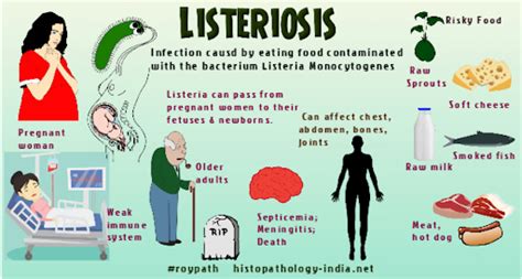 What Type of Bacteria Causes Listeriosis? [UPSC Notes Download]