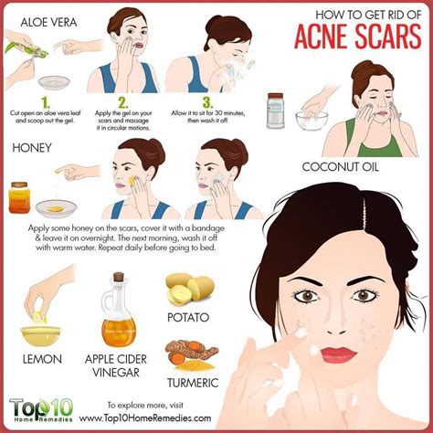 Pin on Acne Scars