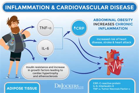 Visceral Fat: What is It and How it Drives Up Inflammation - DrJockers.com