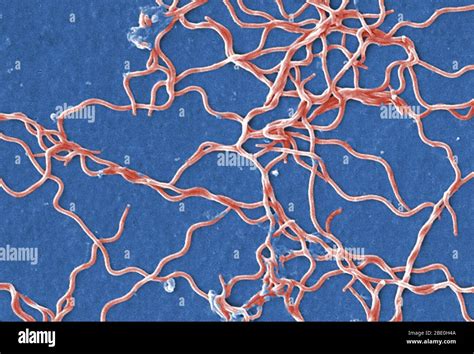 Lyme disease spirochetes hi-res stock photography and images - Alamy