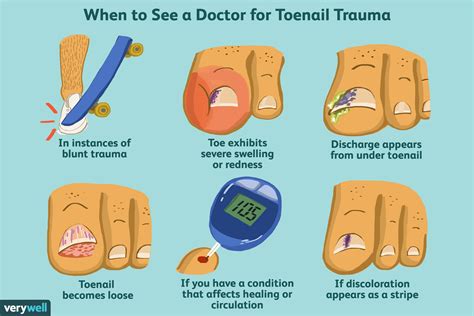 Bruised Toenail: Causes and How to Treat