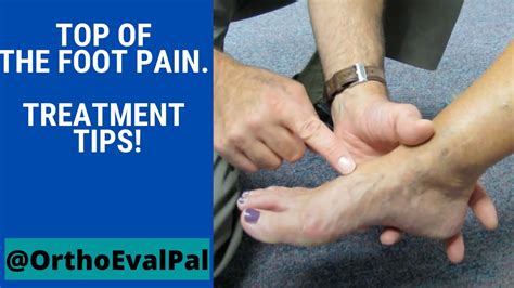 Top of the foot pain. Treatment tips! - YouTube