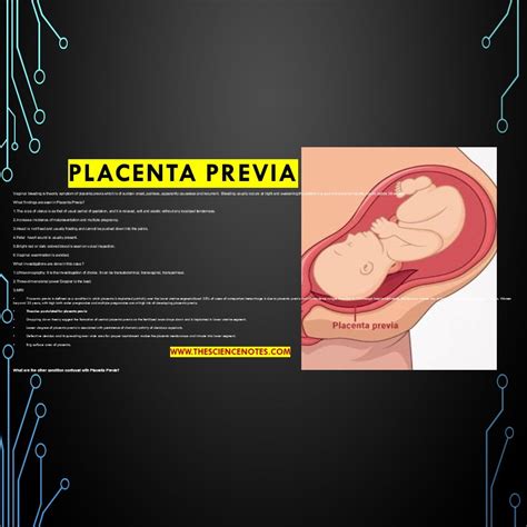 Placenta previa: Theories, Types, Complications, Management, and ...