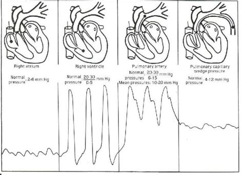 Pin on Cardiology