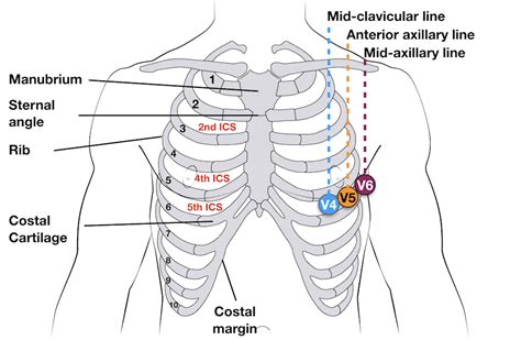 ECG Lead positioning • LITFL Medical Blog • ECG Library Basics Med ...