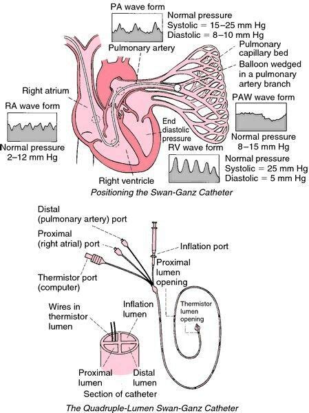 Pin on Nursing School Cardiac Test