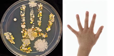 The Bacteria Found on the Hand of an 8-Year-Old After Playing Outside ...