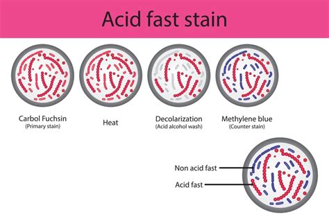 Principle and Procedure of Acid Fast Staining - Solution Parmacy