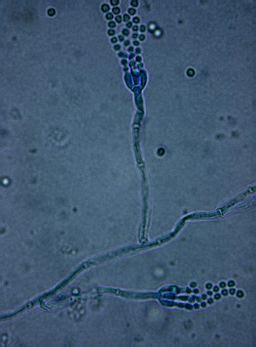 Penicillium Microscopy - Requirements, Preparation & Observation