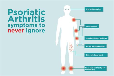 Psoriatic Arthritis Signs and Symptoms