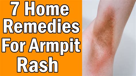 7 Home Remedies For Armpit Rash - YouTube