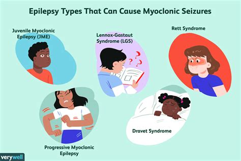 Epilepsy Types