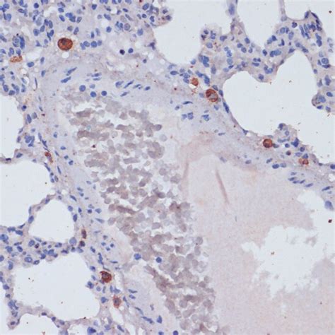 Perforin Antibody (PA5-87351)