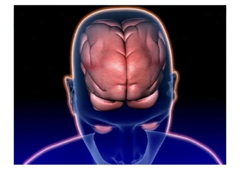 Lesson 7 broca's aphasia and wernicke's aphasia