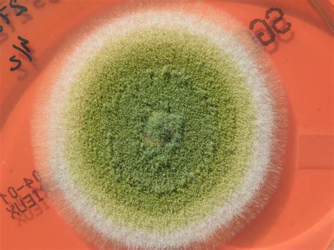 ATLAS MICOLOGIA: ASPERGILLUS FLAVUS