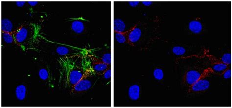 Endothelial Cell Markers - Primary Antibodies