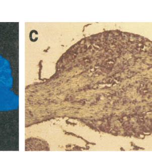 Northern blot and in situ hybridization. a, Northern blot with 4 g of ...