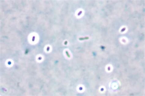 Capsule Stain: Principle, Procedure, Results – Microbe Online