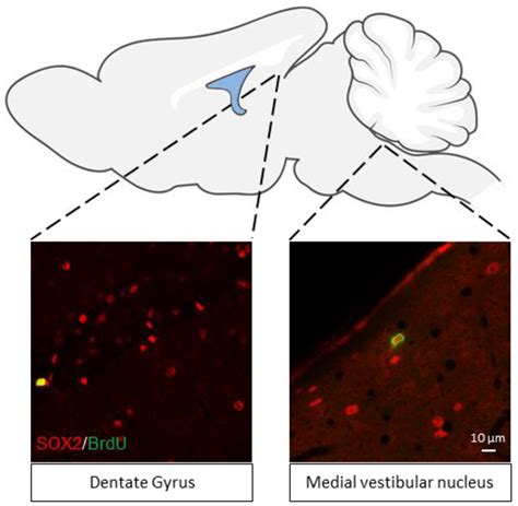 IJMS | Free Full-Text | The Vestibular Nuclei: A Cerebral Reservoir of ...