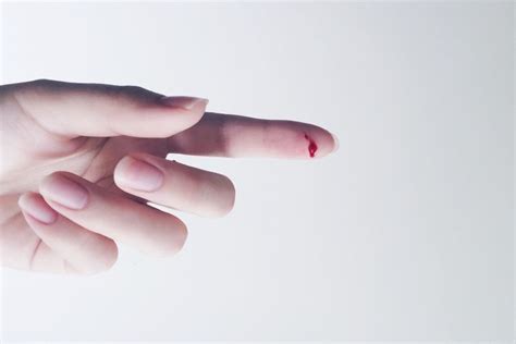 Common Causes of Finger Injuries