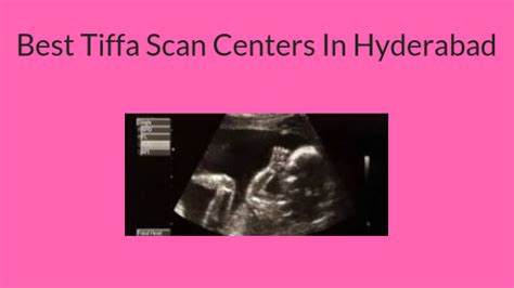 Best Tiffa Scan Centers In Hyderabad - TrueCare Surgicals