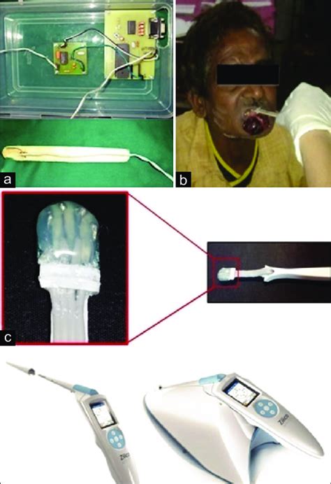 The image of the bioimpedance spectroscopy tool across the included ...