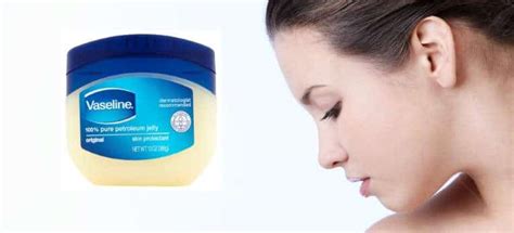 Fact or Fiction: Does Vaseline Really Cause Acne?