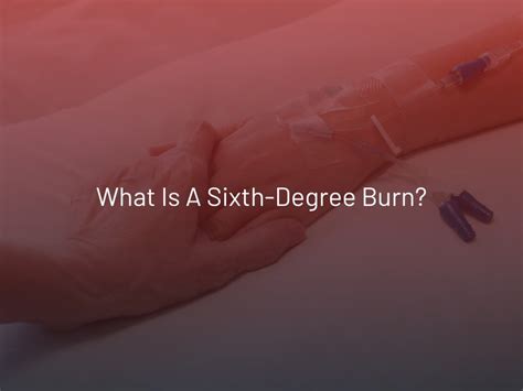 What is a Sixth-Degree Burn?