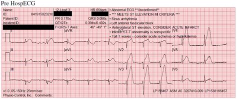 12-lead EKG transmission | ASM-AETNA Blog